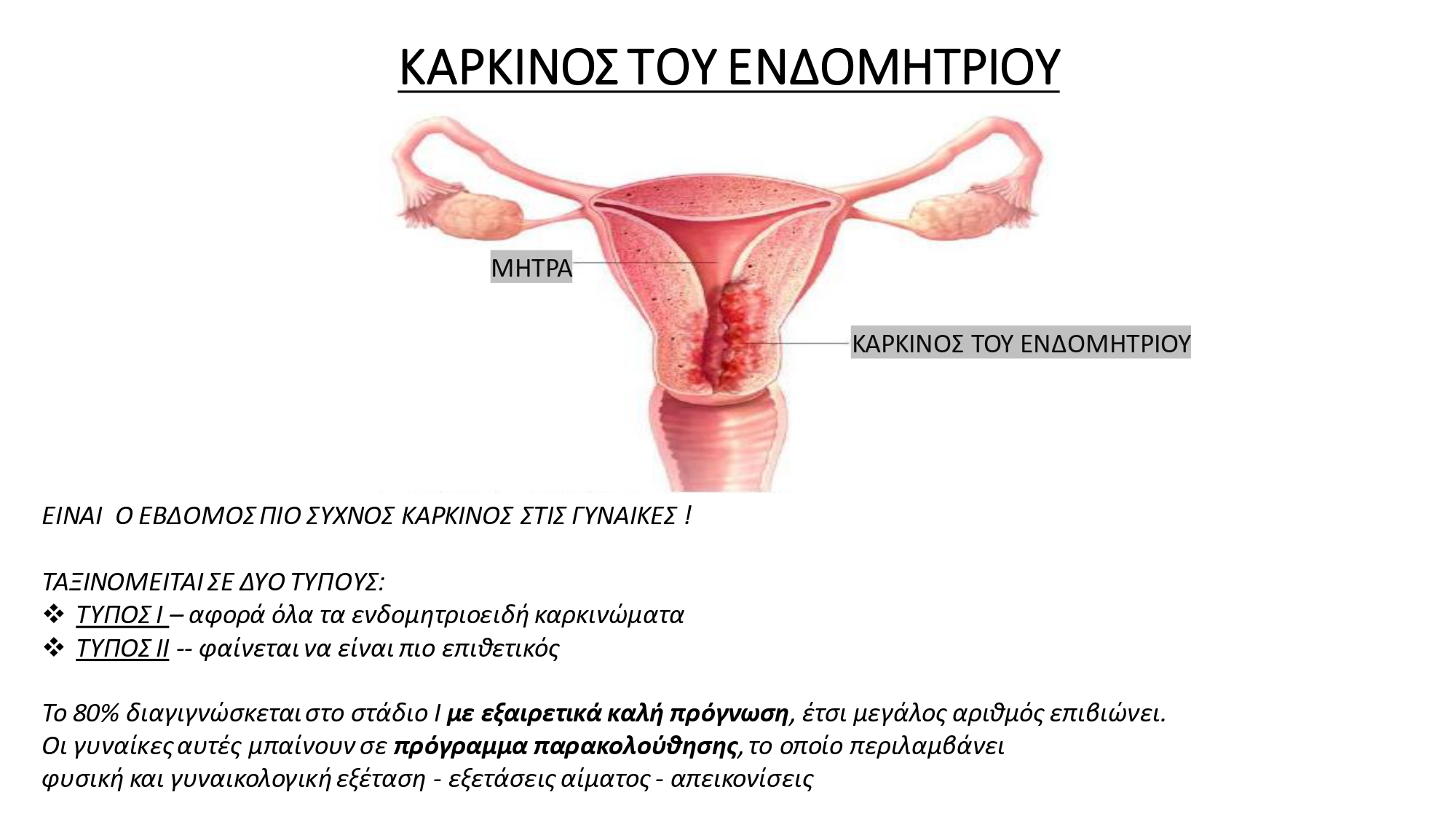 Καρκίνος του Ενδομητρίου_1 Καρκίνος του Ενδομητρίου_1